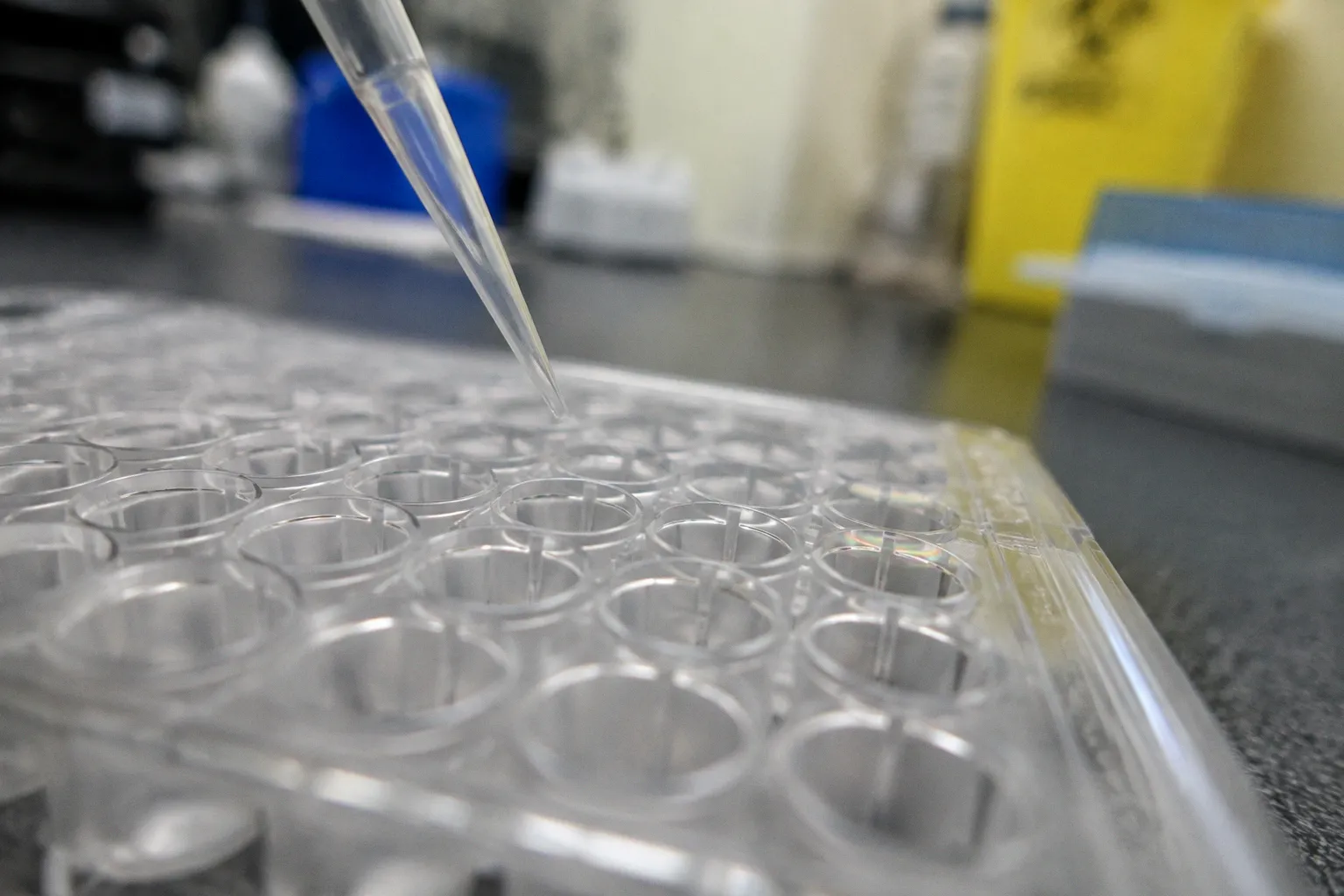 Amplicon Carryover: Anatomy of a Multiplex PCR Error