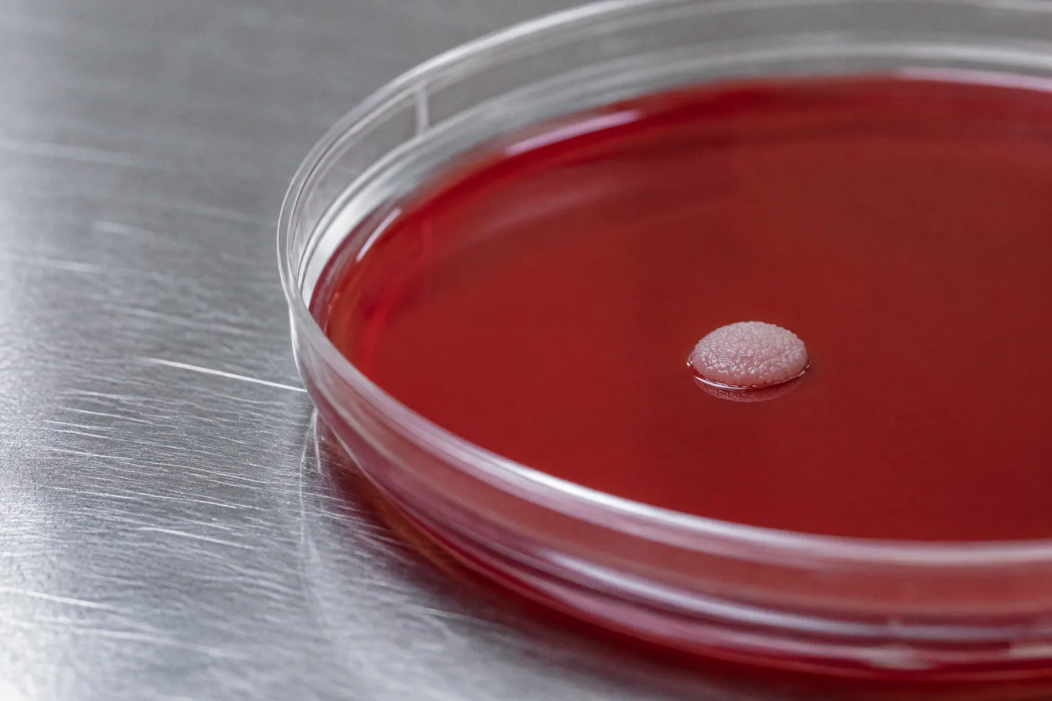 Genotypic Resistance Assays: Can They Replace Standard AST?