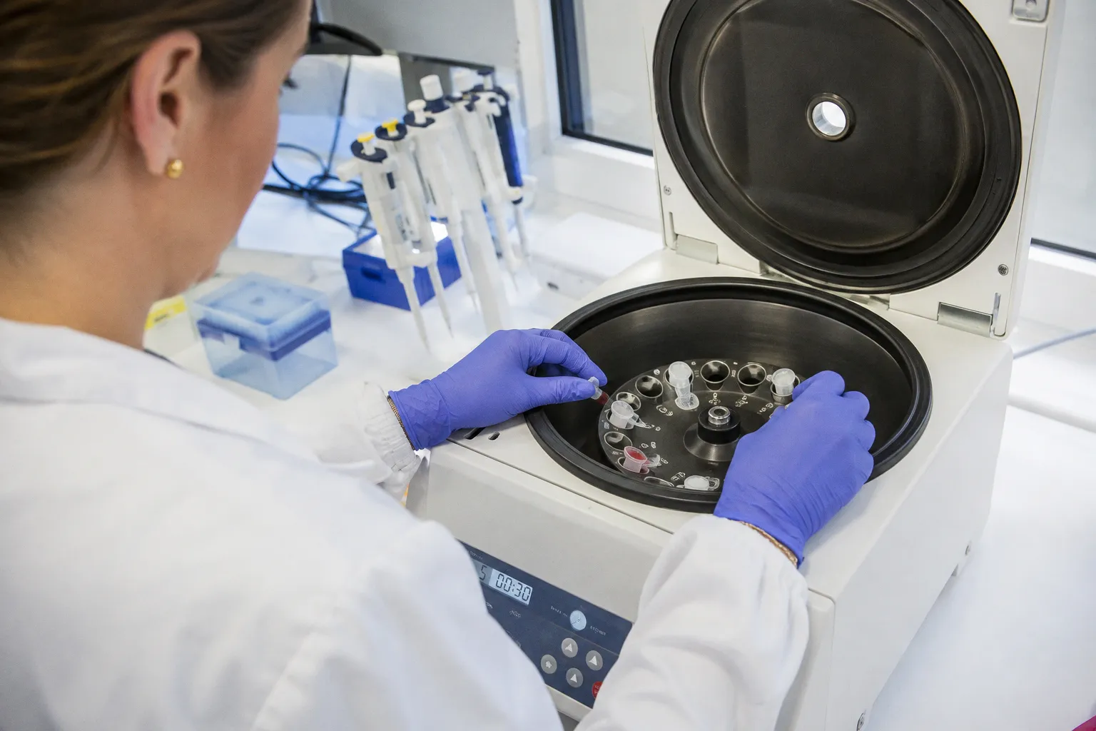 Multiplex PCR Panels: Clinical Impact and Real Utility