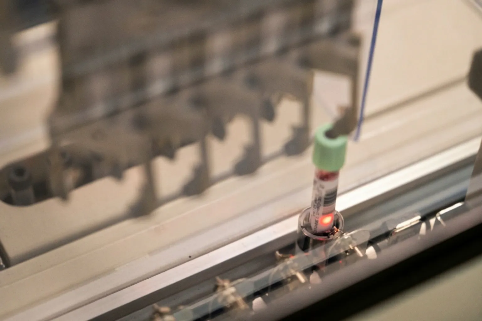 New Blood-Based Assay PANXEON Detects Early-Stage Pancreatic Cancer