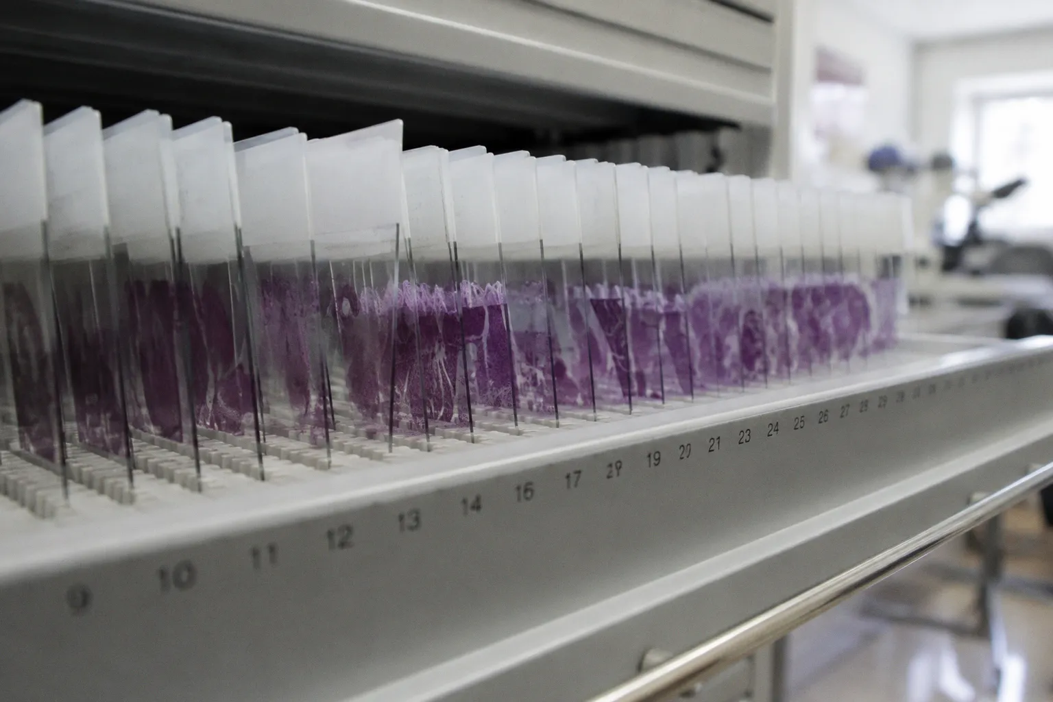 New Governance Standards for AI Implementation in Histopathology Laboratories